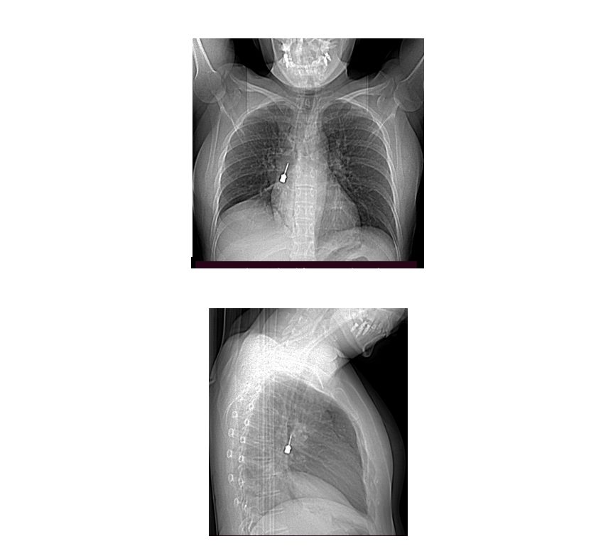 immagine ch toracica 1