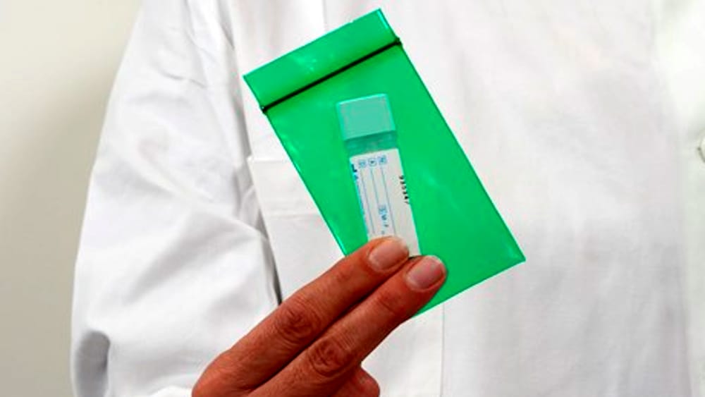 esame screening colon retto-2